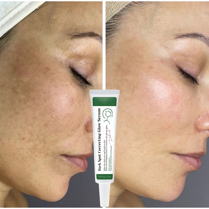 Dark Spot Correcting Glow Serum Brightening Skincare