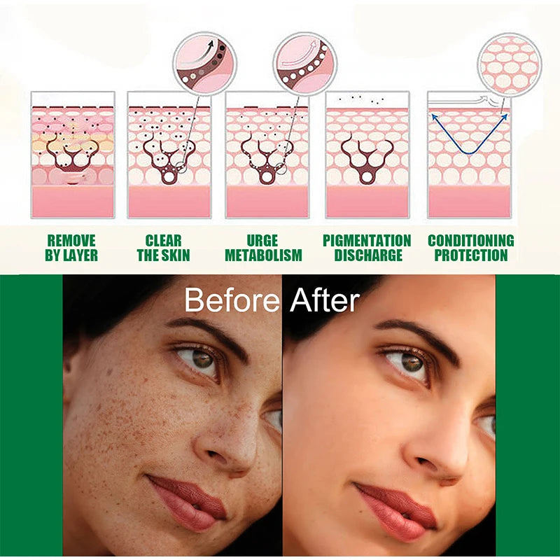 Dark Spot Correcting Glow Serum Brightening Skincare